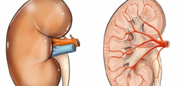 علاج رمل الكلى موضوع